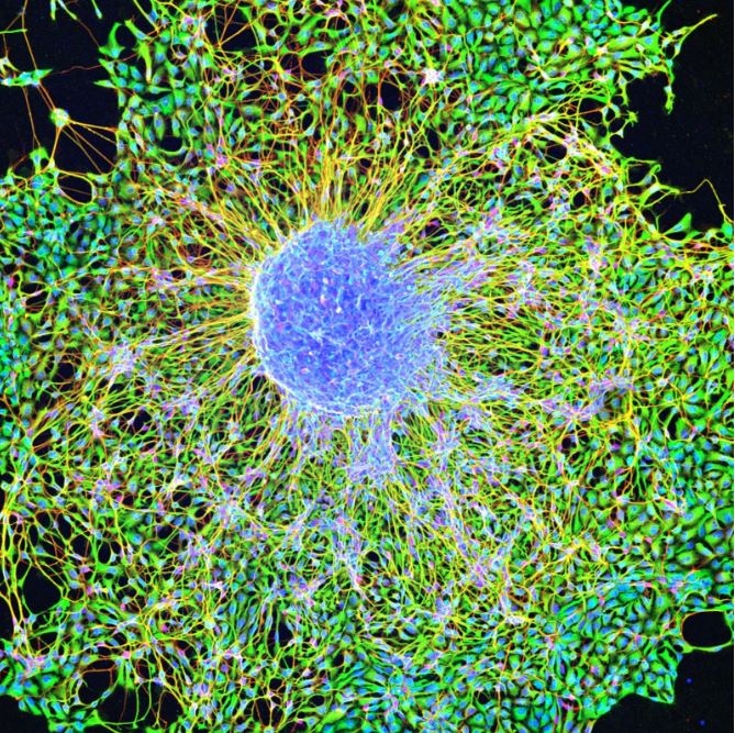 Pluripotent or embryonic stem cell